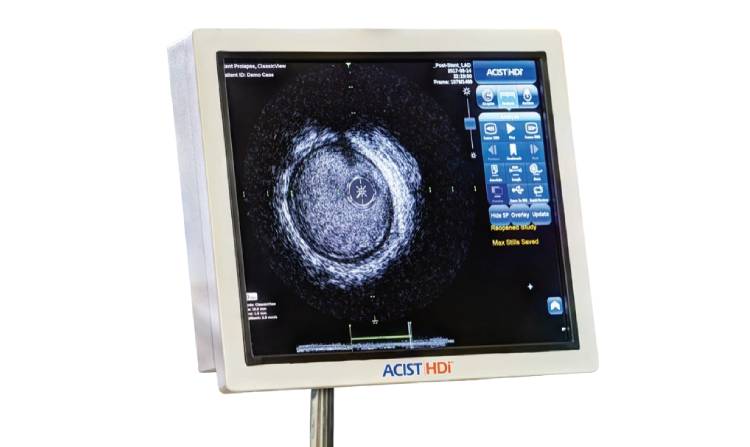 ASICST HDi HD IVUS System