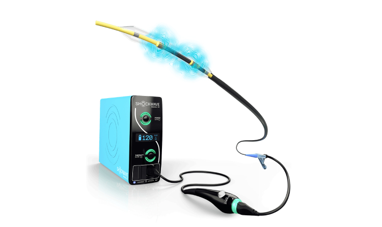 Shockwave C2 | C2+ Coronary IVL Catheter